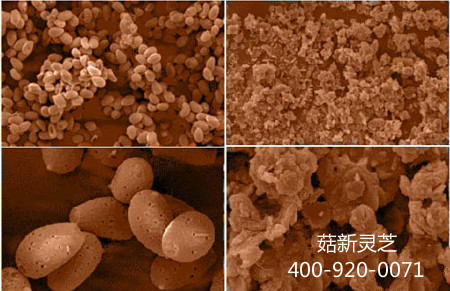 電子顯微鏡下兩款靈孢子粉的對比圖